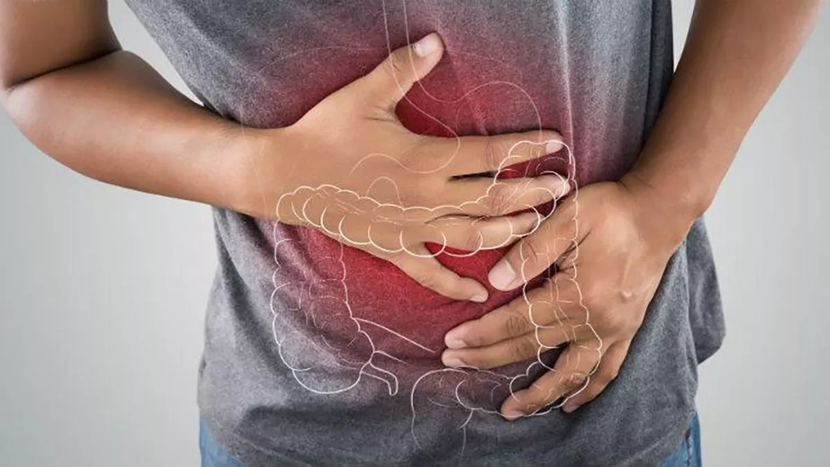 Colon Irritable: Síntomas y su relación con el estrés